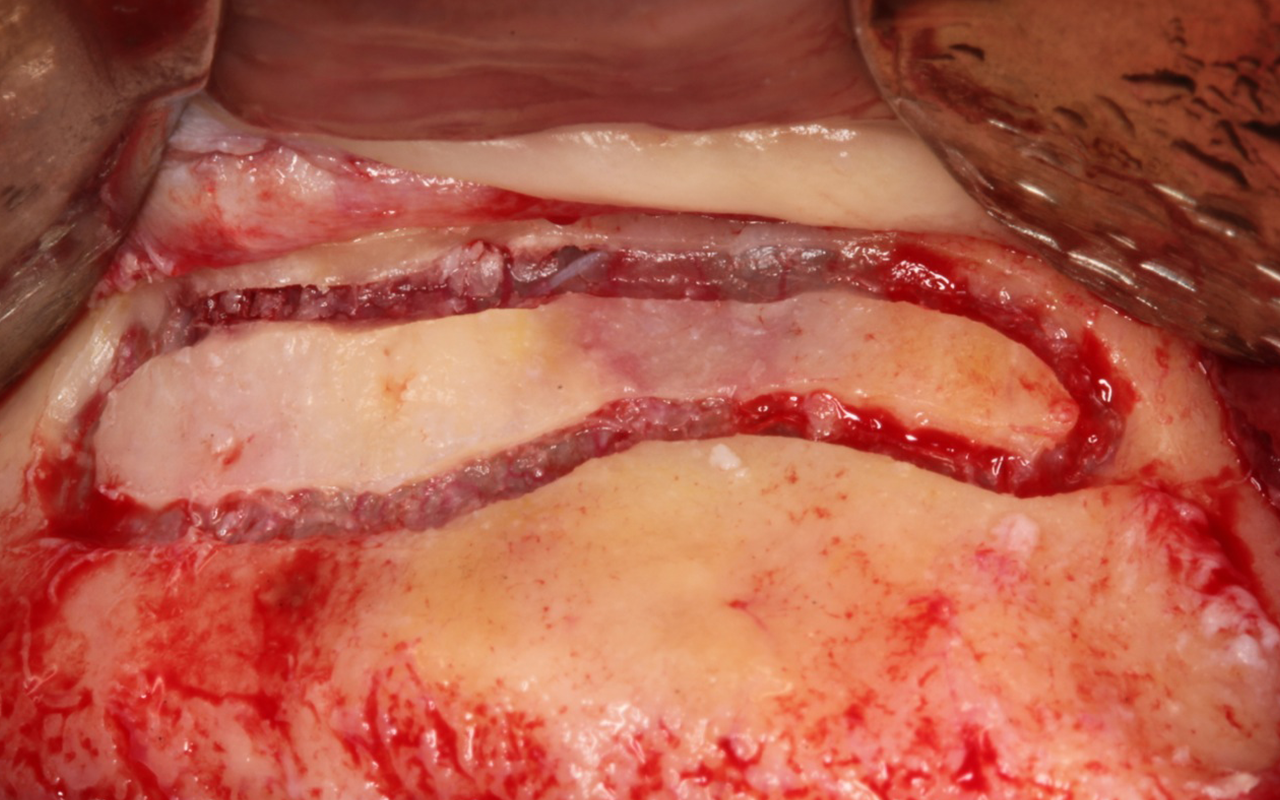 clinical_gbr_1