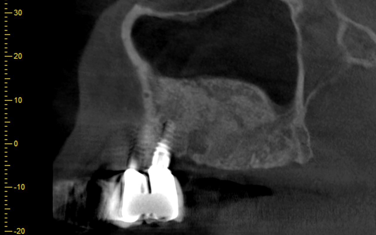 clinical_gbr_2