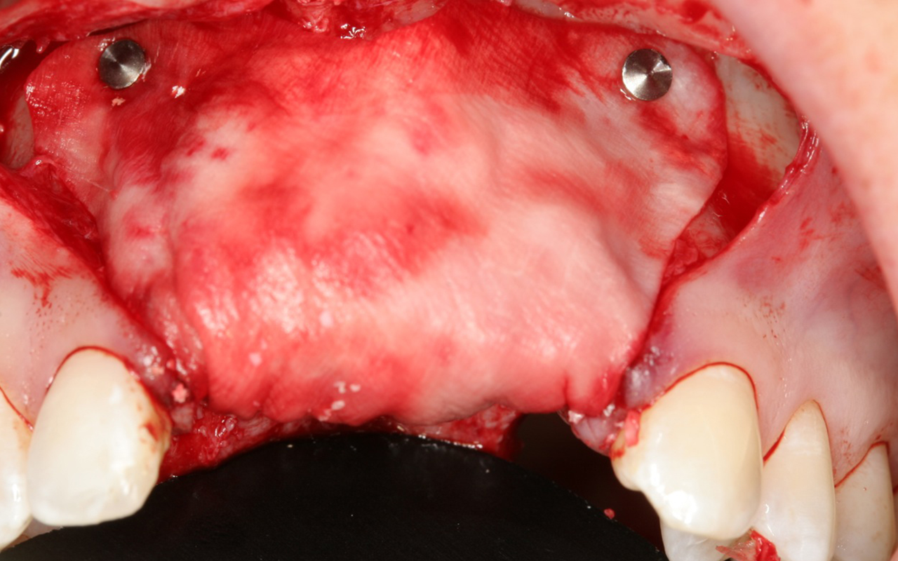 clinical_gbr_4