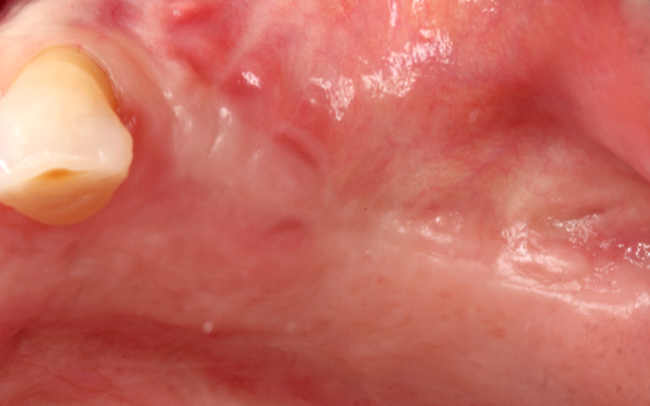 soft_tissue_clinical_1