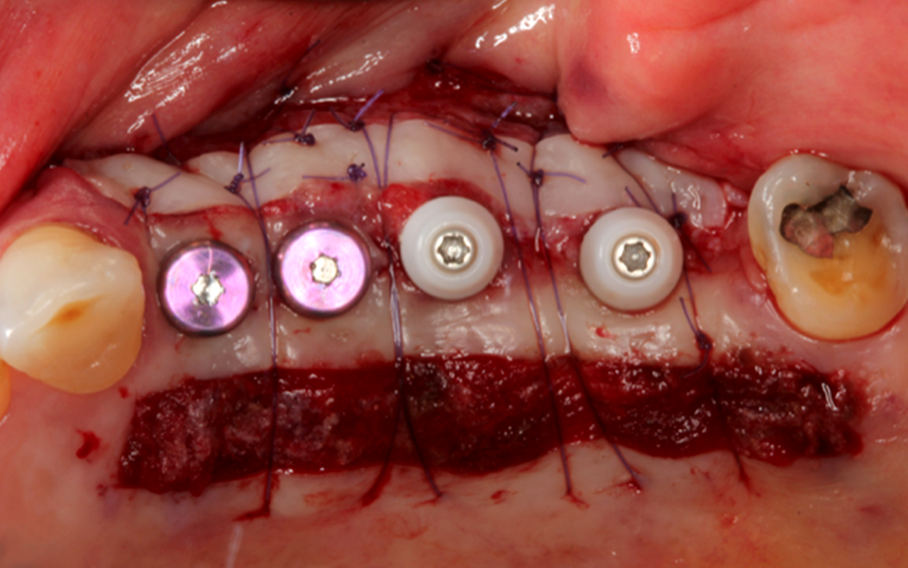 soft_tissue_clinical_2