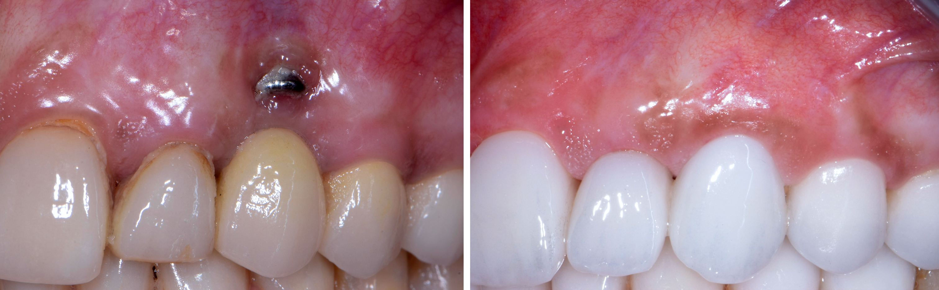 clinical_image1