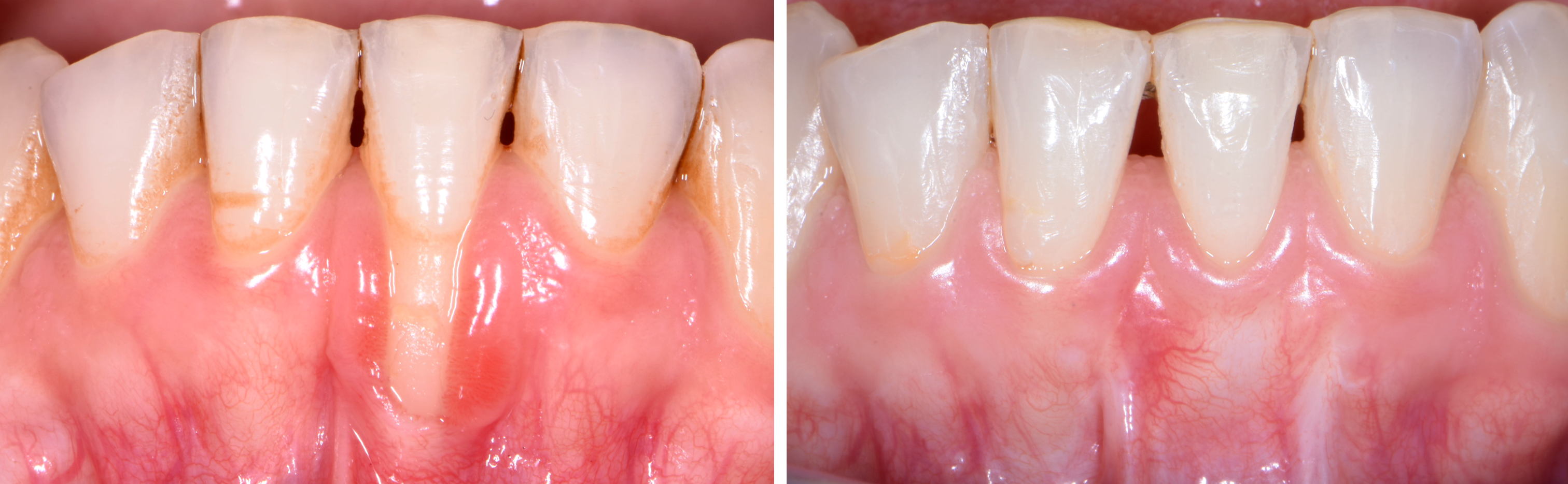 clinical_image2