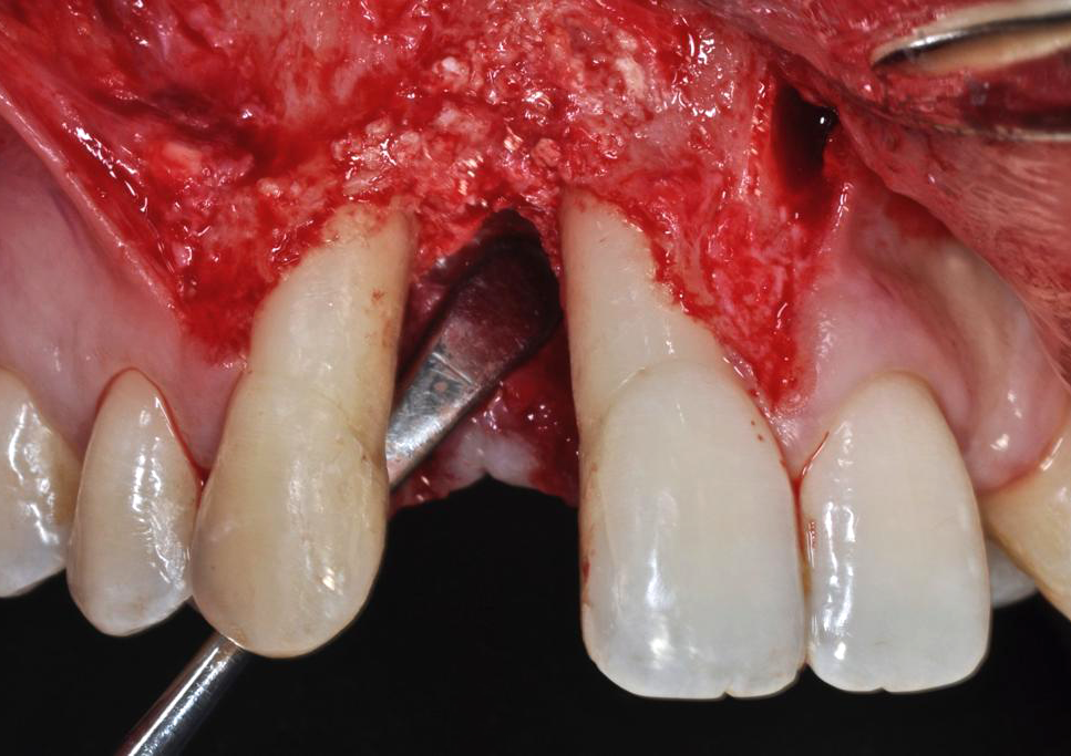 case1_2
