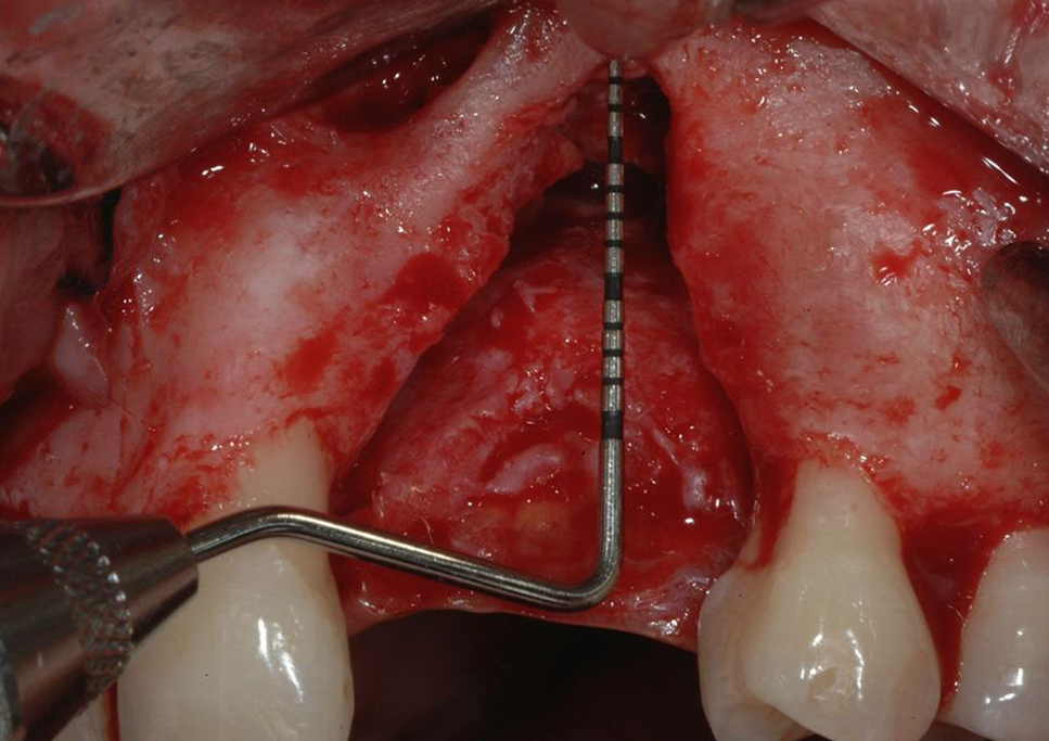 case2_1