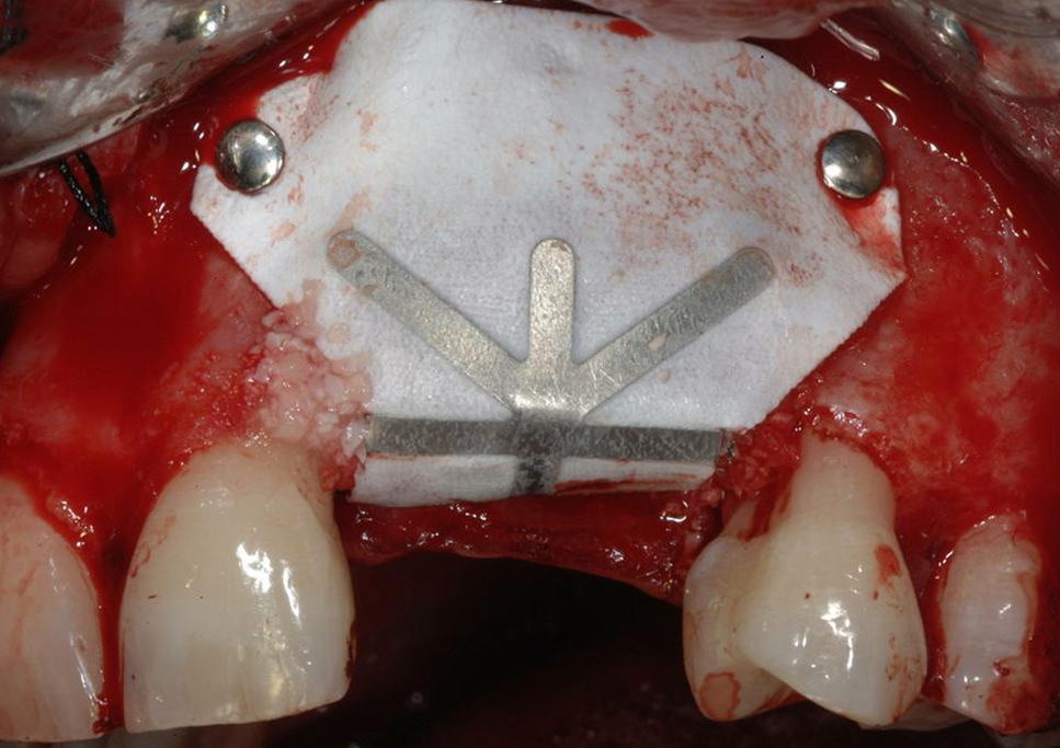 case2_2