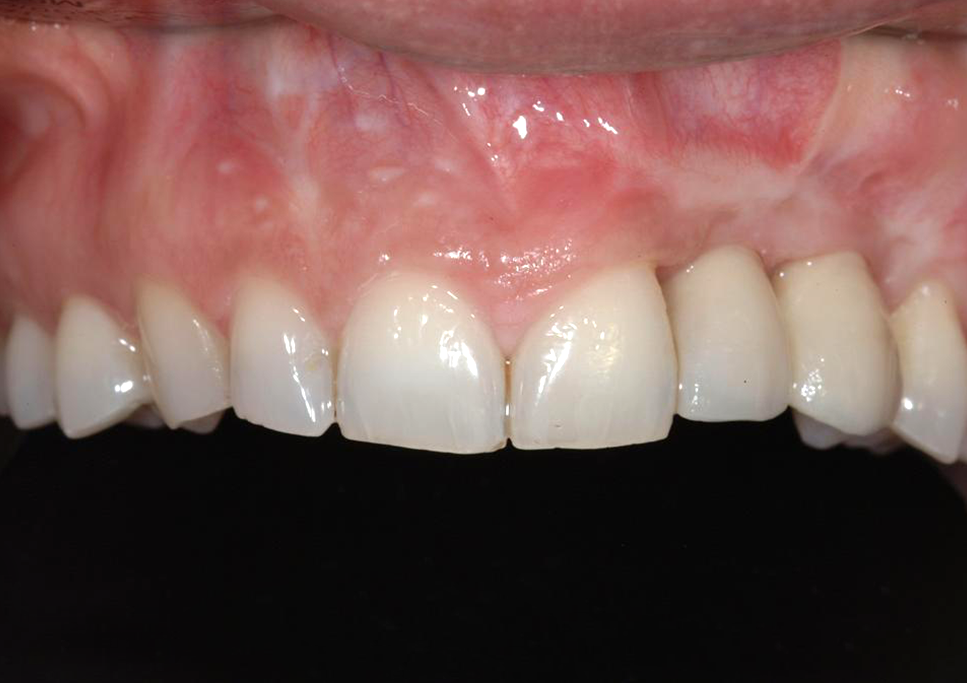 case2_4